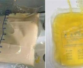 [轉貼][新聞] 3餐都叫外賣 OL血漿變「豬油色」